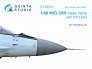 1/48 MiG-29K corrected nose cone for HobbyBoss